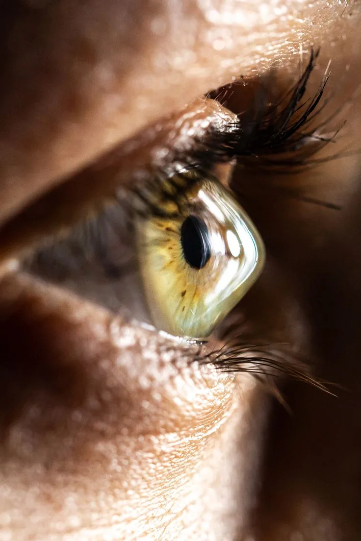 Keratoconus treatment Amritsar