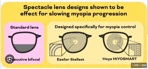imgi_1_Myopia control Glasses0DI119AS0P